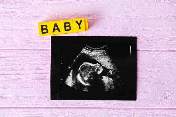 Ultrasound baby scan — Stock Photo, Image