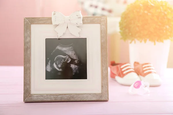 Ultrasound baby scan — Stock Photo, Image