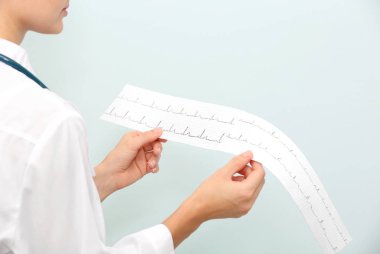 Steteskoplu kadın doktor arka planda elektrokardiyogram tutuyor.