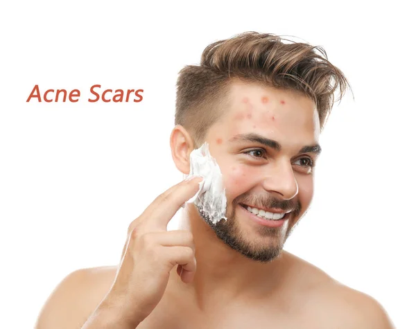 Young man applying shaving foam — Stock Photo, Image