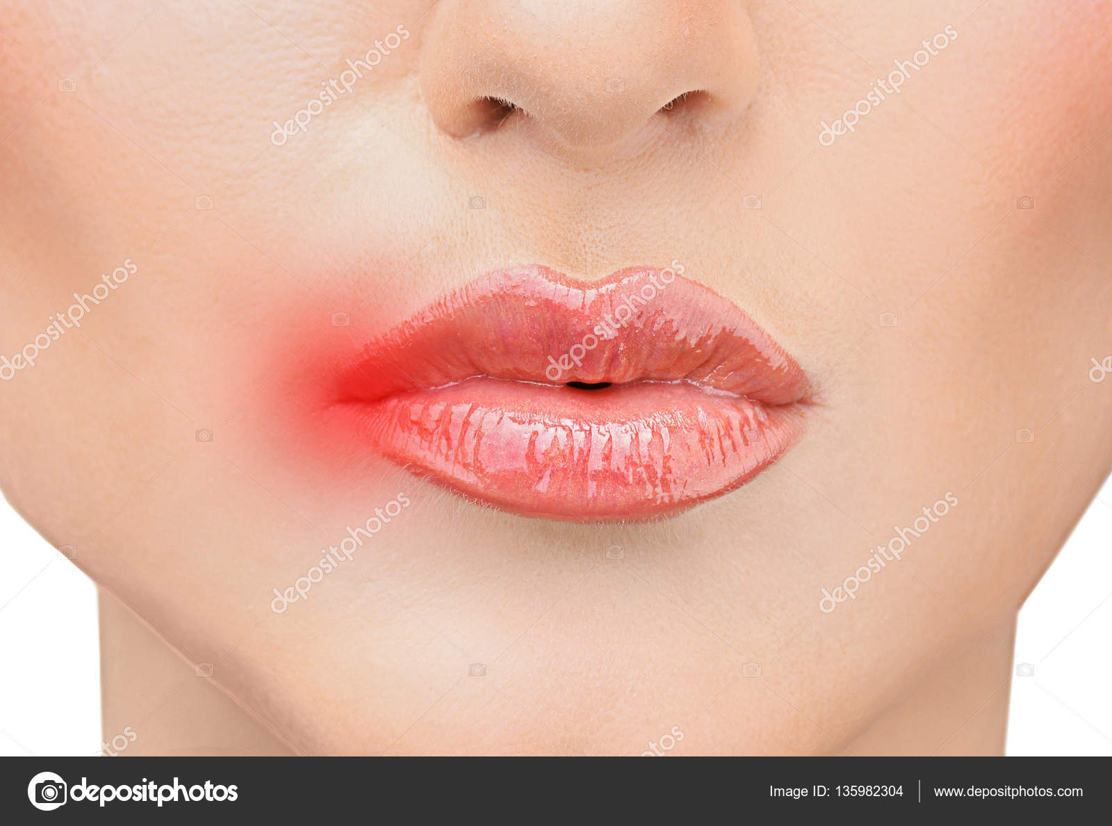 болят губы после поцелуя