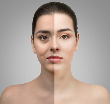 Woman face before and after cosmetic procedure. Plastic surgery concept. clipart