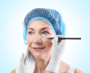 Surgeon drawing marks on female face against blue background. Plastic surgery concept clipart