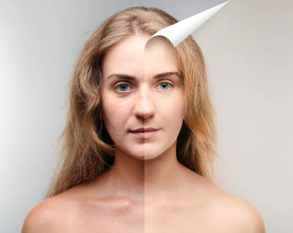 Wanita Menghadapi Sebelum Dan Sesudah Prosedur Kosmetik Konsep Pembedahan Plastik — Stok Foto