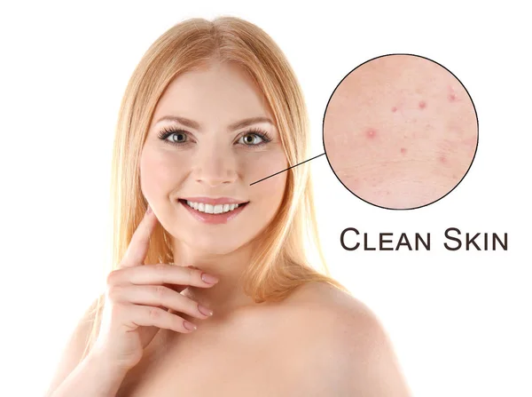 Skin care koncepciót. Fiatal nő fehér háttér — Stock Fotó
