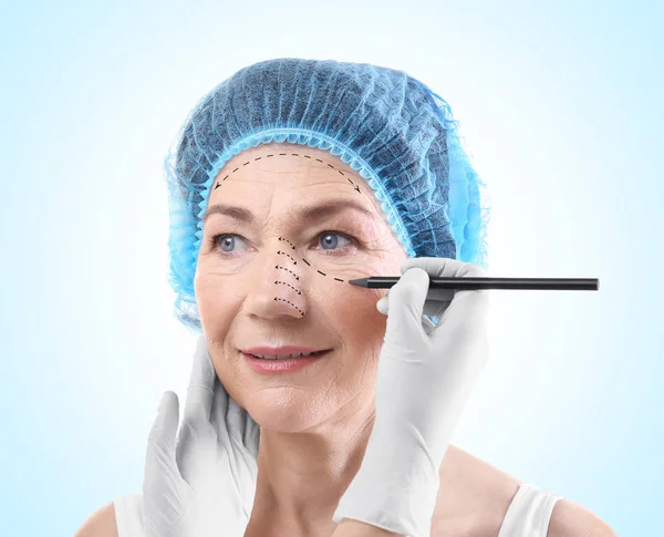 Surgeon drawing marks on female face against blue background. Plastic surgery concept — Stock Photo, Image