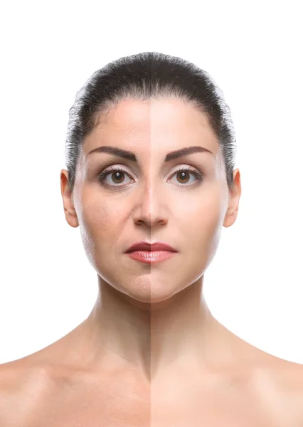 Woman face before and after cosmetic procedure. Plastic surgery concept. — Stock Photo, Image