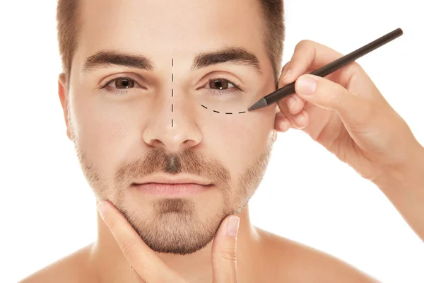 Хирург рисует следы на мужском лице на белом фоне. Концепция пластической хирургии — стоковое фото