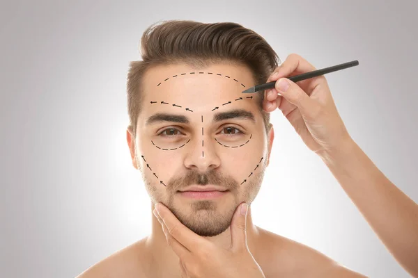 Chirurg zeichnet Markierungen im männlichen Gesicht vor grauem Hintergrund. Konzept der plastischen Chirurgie — Stockfoto