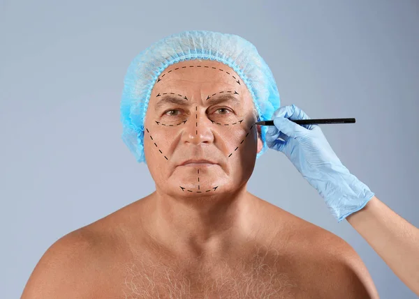 Хирург рисует знаки на мужском лице на цветном фоне. Концепция пластической хирургии — стоковое фото