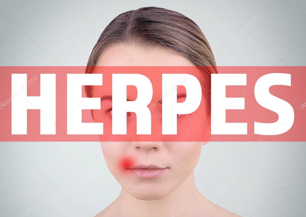 Word HERPES and woman on background