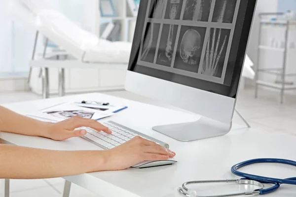 Médico examinando rayos X en la computadora — Foto de Stock