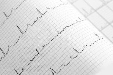 Elektrokardiyogram kağıt