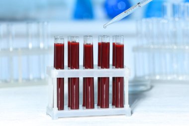 test tüpleri ile kan 