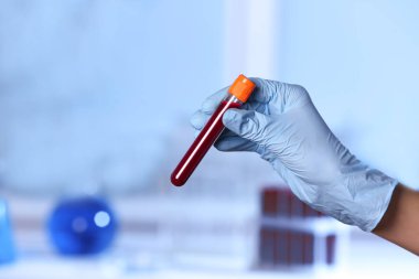 El ele tutuşan test tüpü