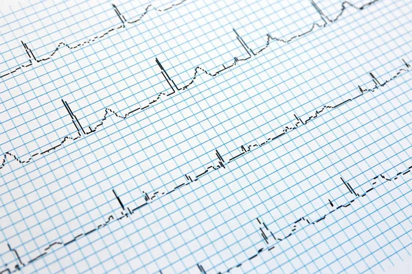 EKG papír formában — Stock Fotó
