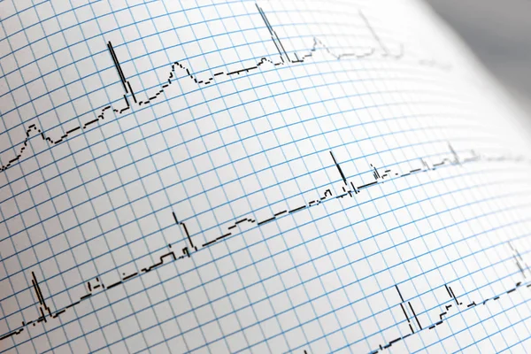 Electrocardiogram in paper form