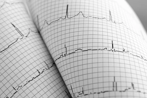 EKG w formie papierowej — Zdjęcie stockowe