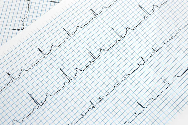 Eletrocardiograma em papel — Fotografia de Stock