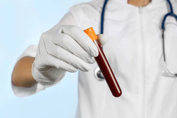 Médico segurando sangue no tubo de teste — Fotografia de Stock