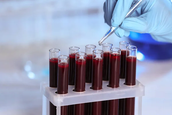 Hand working with test tubes — Stock Photo, Image