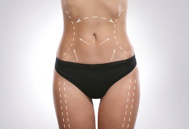 plastik cerrahi kavramı