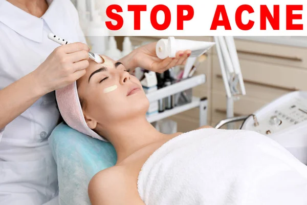 Text STOP ACNE — Stock Photo, Image