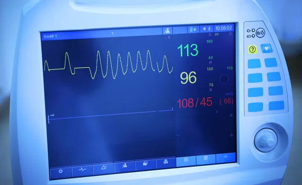 Monitor cardíaco na clínica moderna — Fotografia de Stock