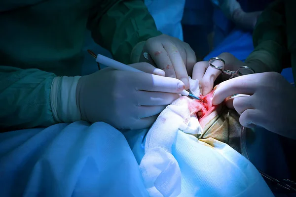 Operation des Patienten im Krankenhaus — Stockfoto