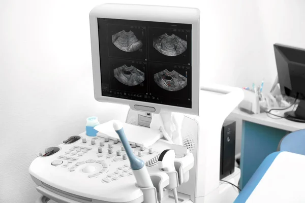 Máquina de ultra-som na clínica — Fotografia de Stock