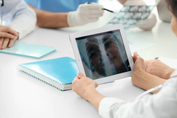 Jonge dokter verkennen Long roentgenogram — Stockfoto