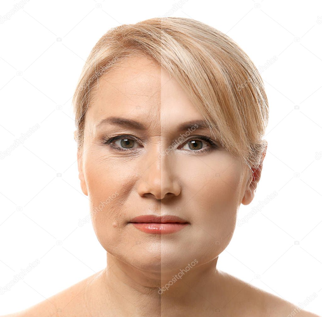 face before and after cosmetic procedure