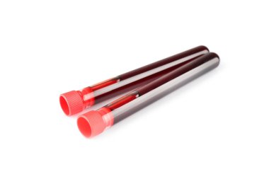 kan örnekleri ile test tüpleri