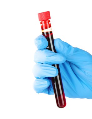 Eldivende test tüpü var.  