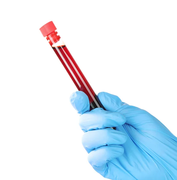 Hand in glove holding test tube — Stock Photo, Image