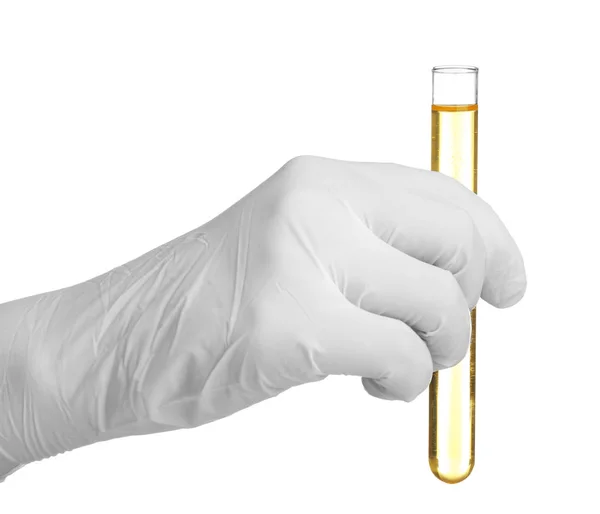 Hand in glove holding test tube with urine on white background — Stock Photo, Image
