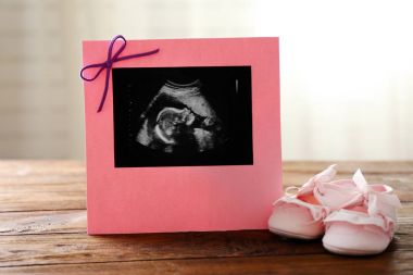 Çerçeve içinde bebeğin ultrason inceden inceye gözden geçirmek 