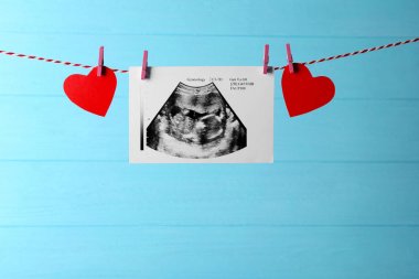 Ultrason bebek inceden inceye gözden geçirmek