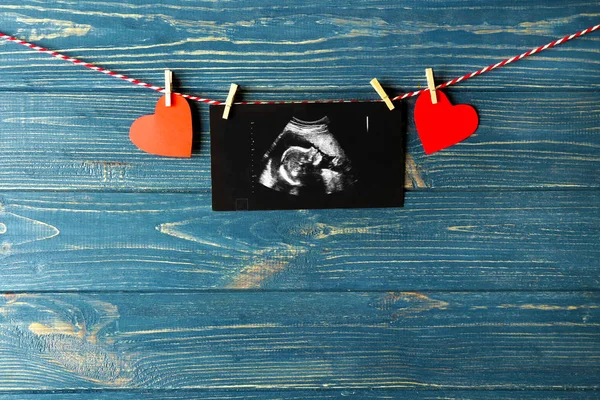 Ultrasound scan of baby on rope — Stock Photo, Image