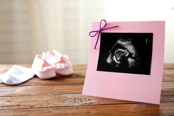 Echografie van baby in frame — Stockfoto