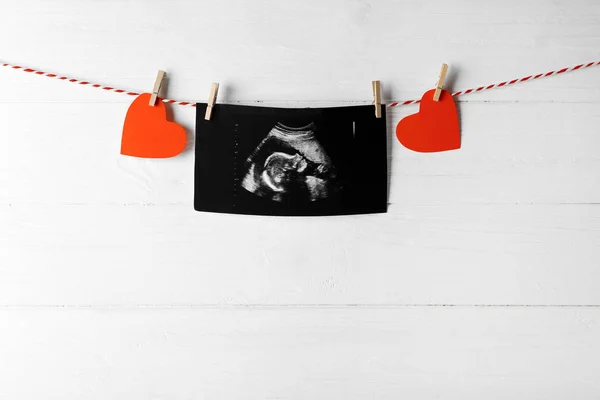 Ultraschalluntersuchung des Babys am Seil — Stockfoto