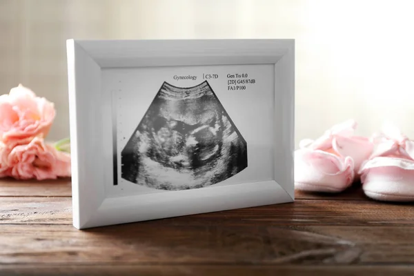 Echografie van baby in frame — Stockfoto