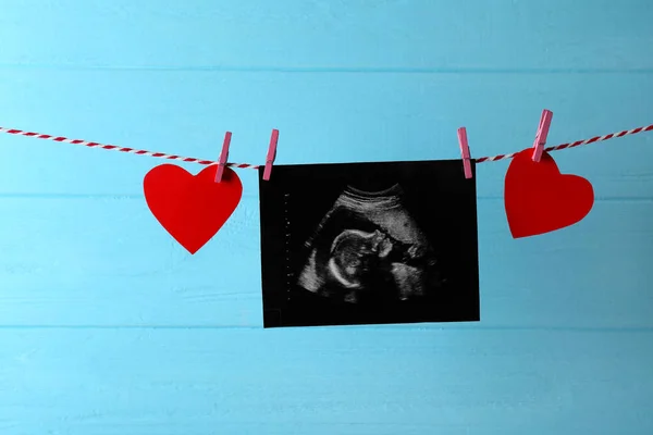Baby ultraljudsundersökning — Stockfoto