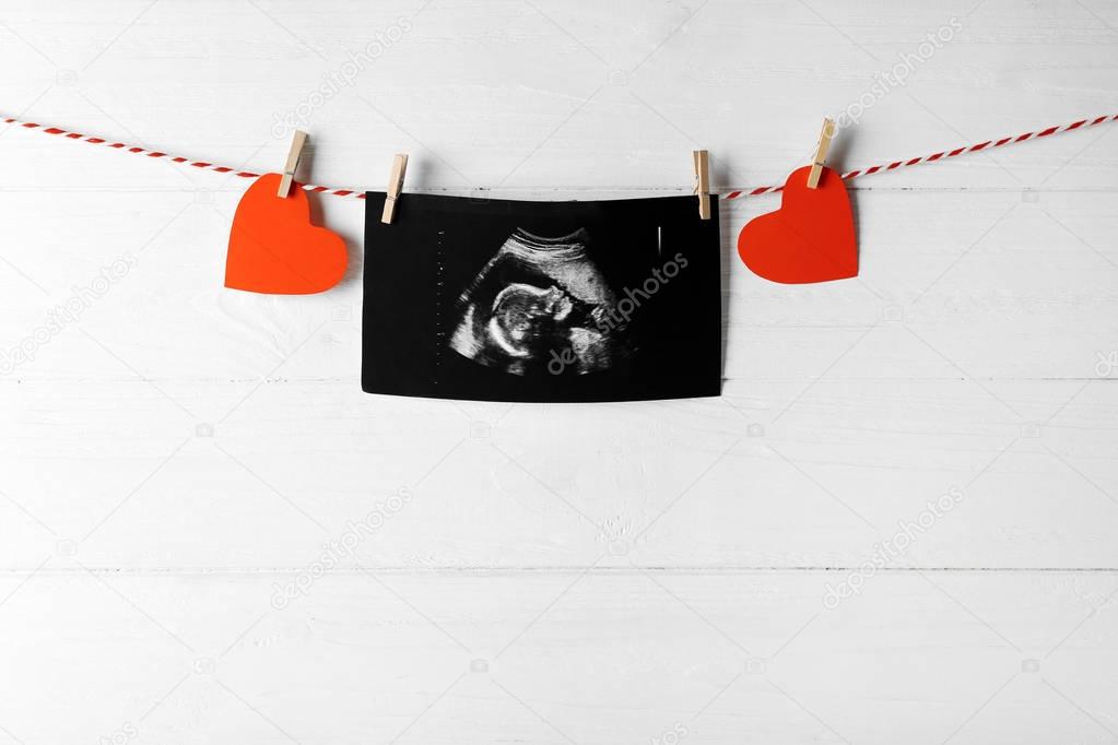 Ultrasound scan of baby on rope