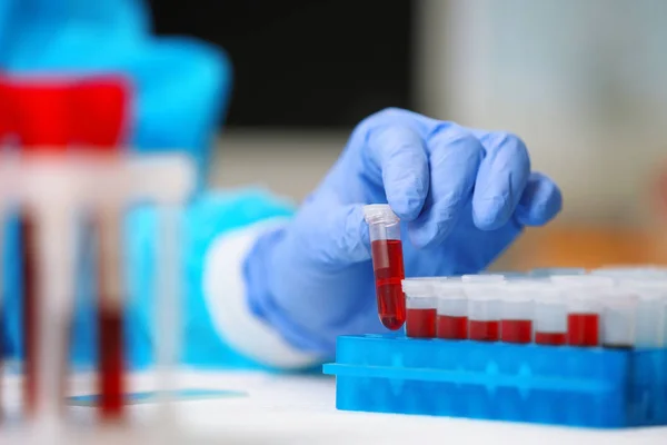Científico trabajando con muestras de sangre — Foto de Stock