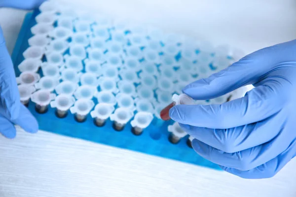 Woman working with blood samples — Stock Photo, Image