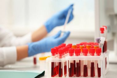 test tüpleri ile kan