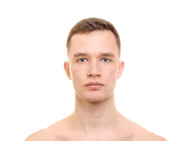 Sorun deri üzerinde beyaz arka plan ile yakışıklı genç