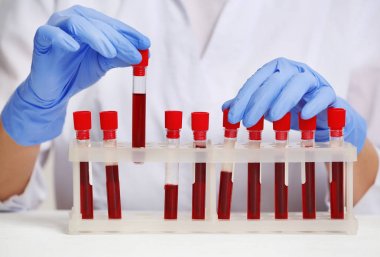 Kan örnekleri ile çalışan kadın 