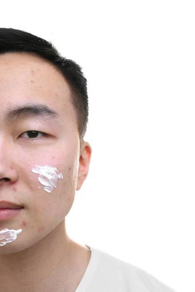 Joven hombre asiático con crema para la piel problemática aplicada en la cara, sobre fondo blanco — Foto de Stock
